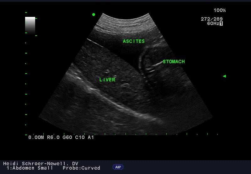 ultrasound