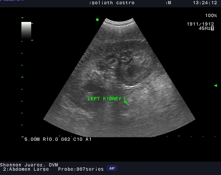 ultrasound